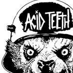 Acid Teeth