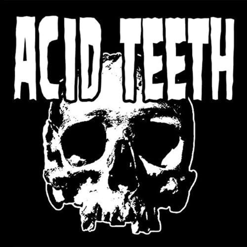 Acid Teeth cover
