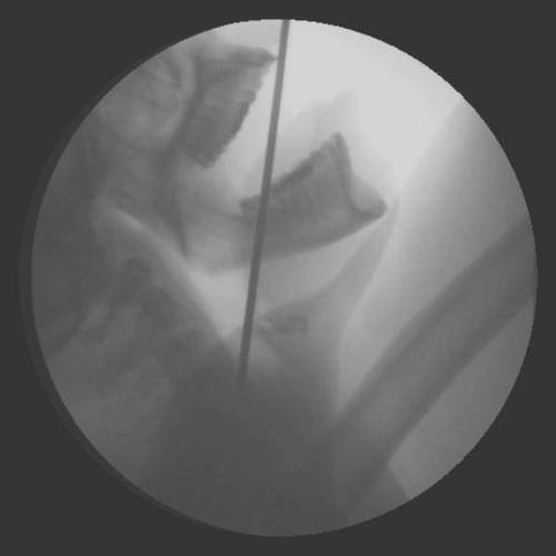 Profile photo 10.Dan_Meyer_Head_x-ray.jpg