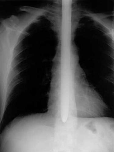 Profile photo 11.DanMeyer_Chest_x-ray.jpg