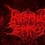 Internal Leprosy